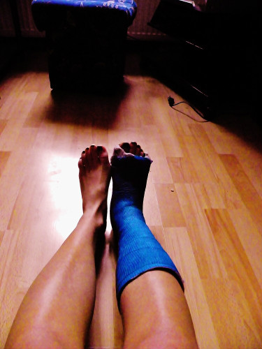 My legs 