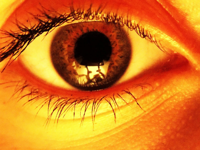 Eye 