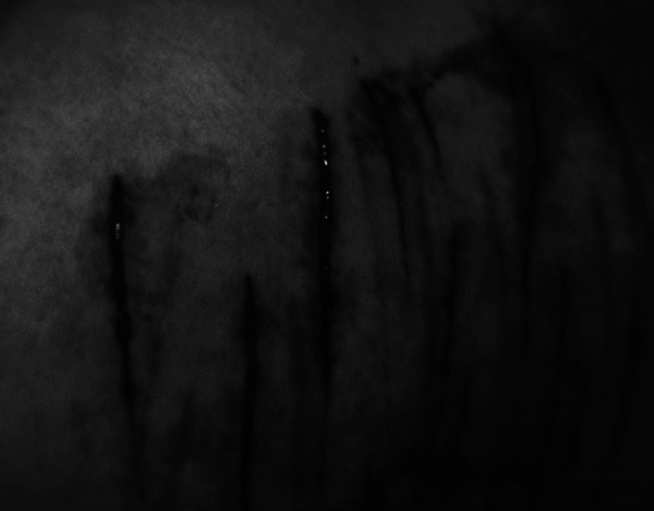 9.