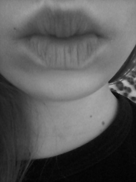 :*