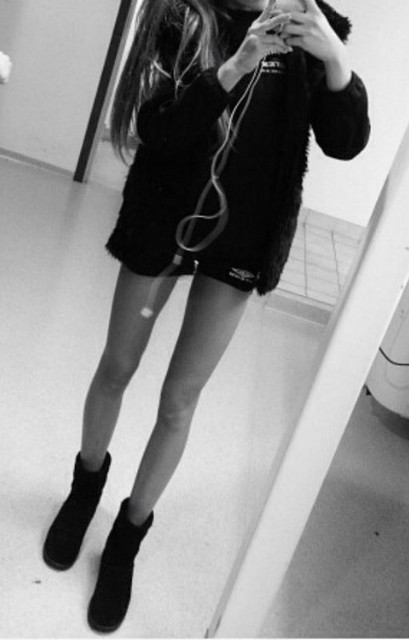 come on, skinny love