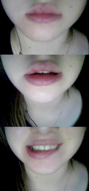 Wpis anitak
