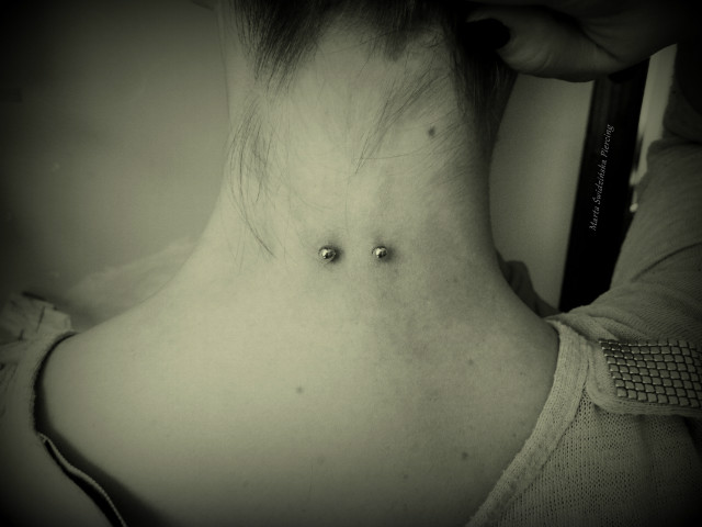 01. Nape