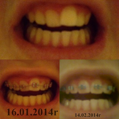 Wpis 00adiszon00