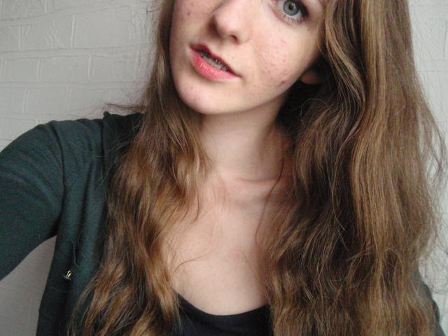 Wpis funnyfreckles