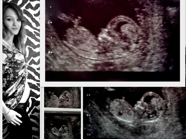 12 tygodni i 5 dni :)