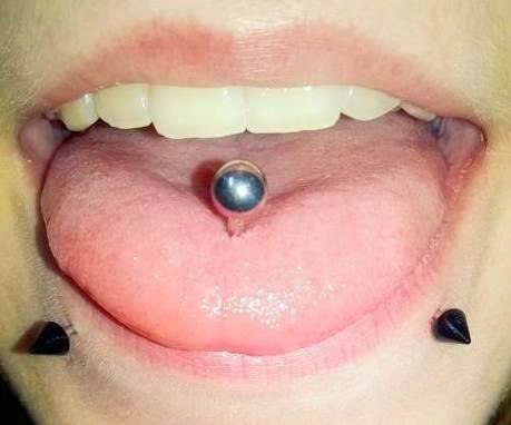 Zagojony tongue