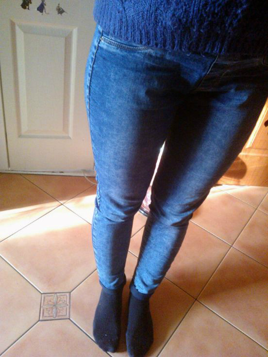 fatlegs