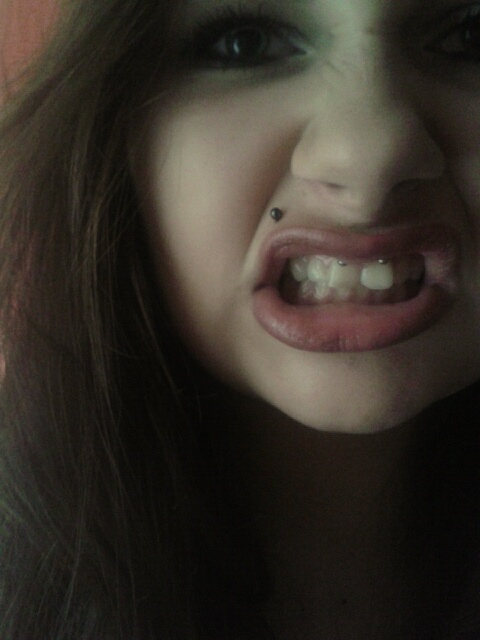 Wpis massacreeeee