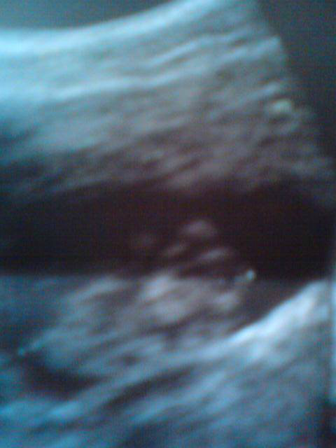 Wpis smallprincessxd