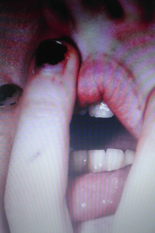Wpis toes