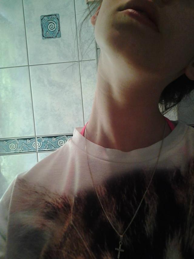 #