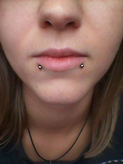Snake bites.