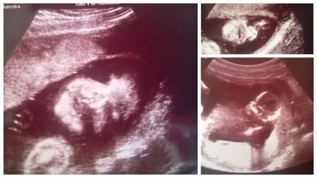 Nasze 900 gram Szczcia :* 