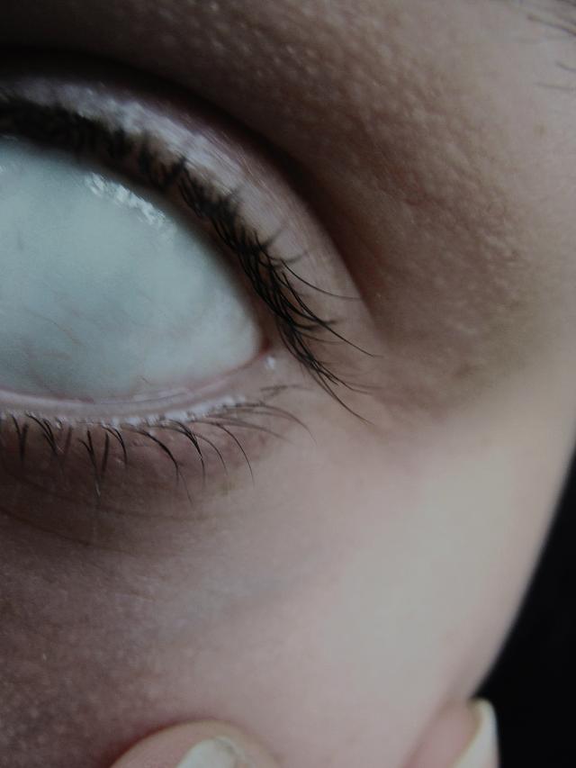insomniac